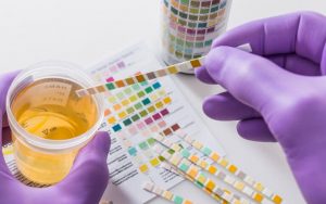 el cbd da positivo en test de drogas